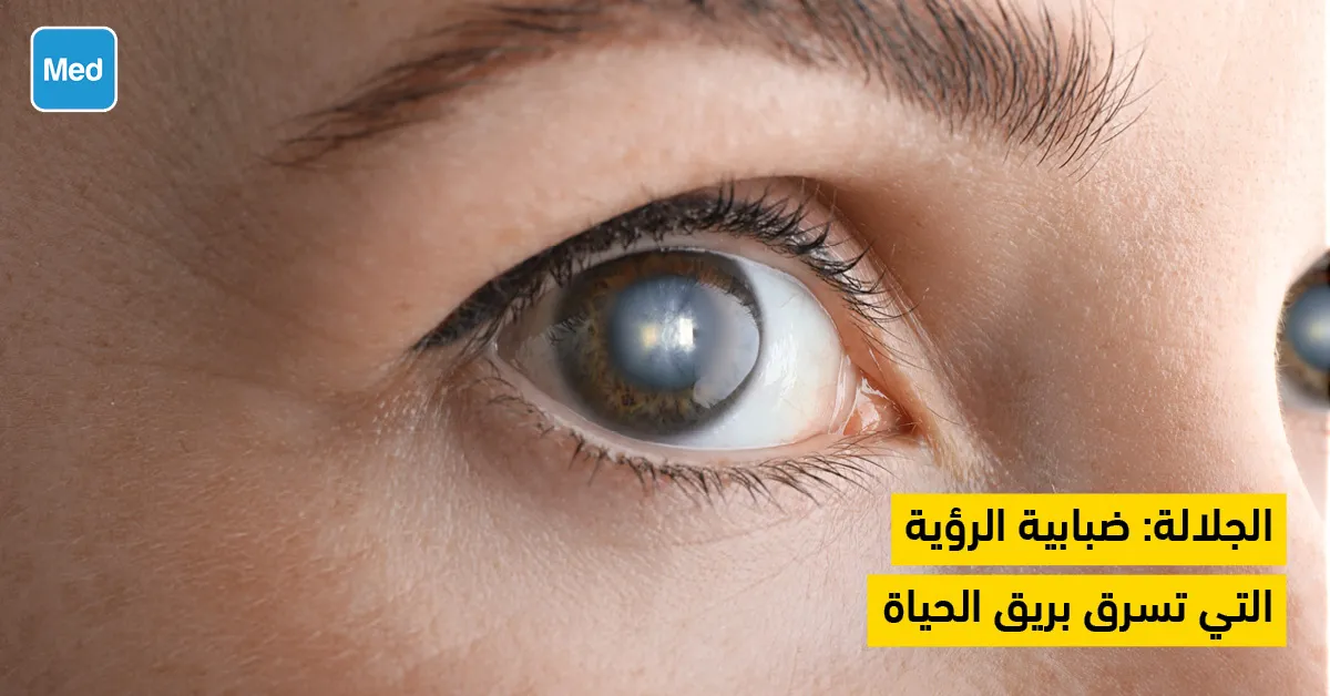 الجلالة: ضبابية الرؤية التي تسرق بريق الحياة